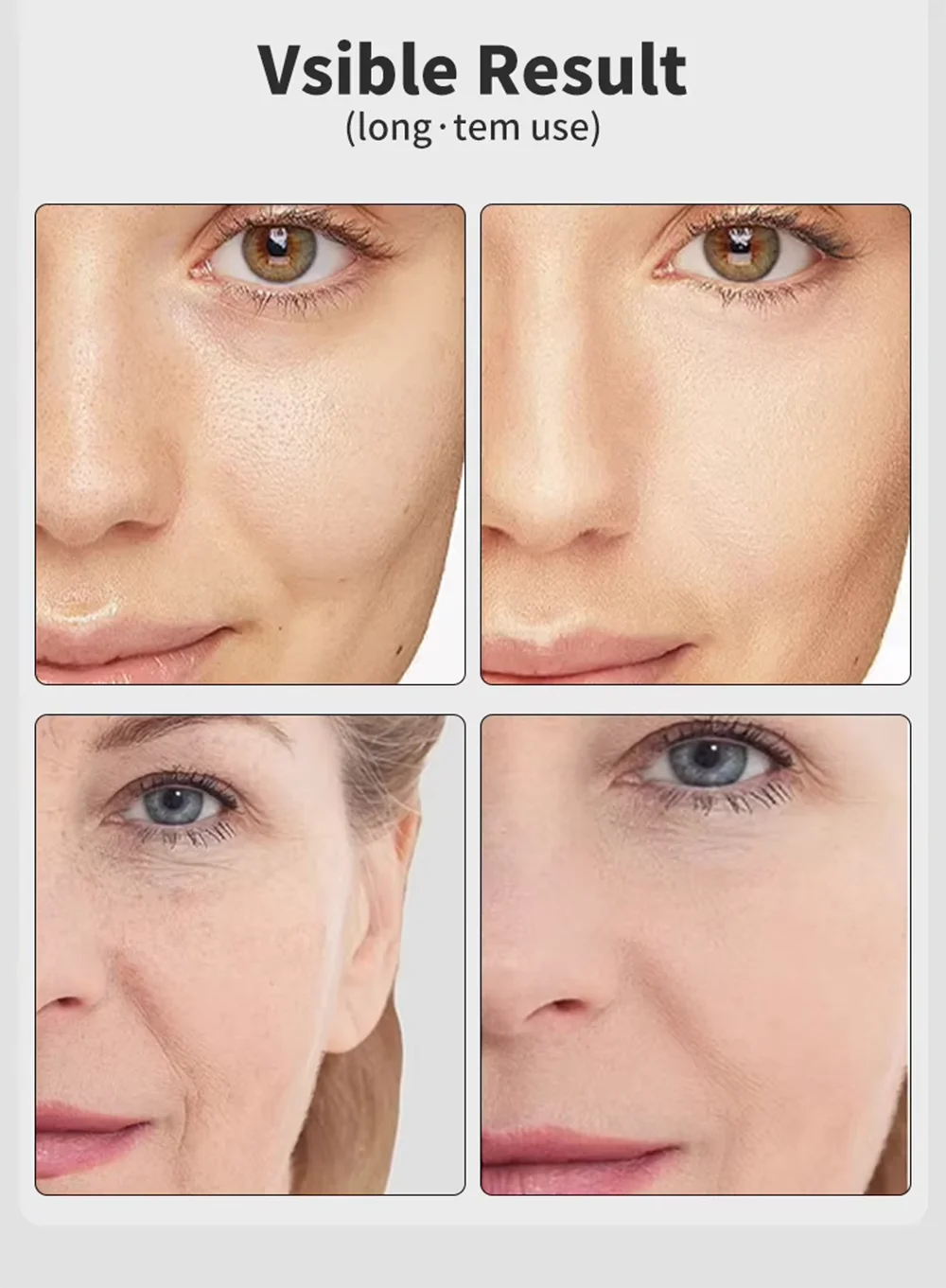 Skinova™ EMS Facial Wand
